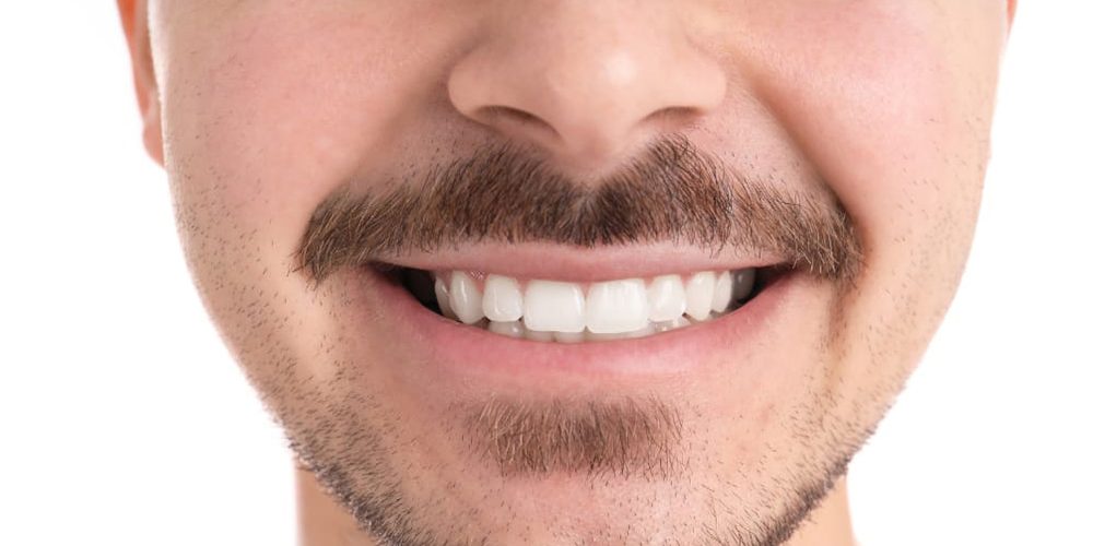 Dopo il trattamento, caso 5